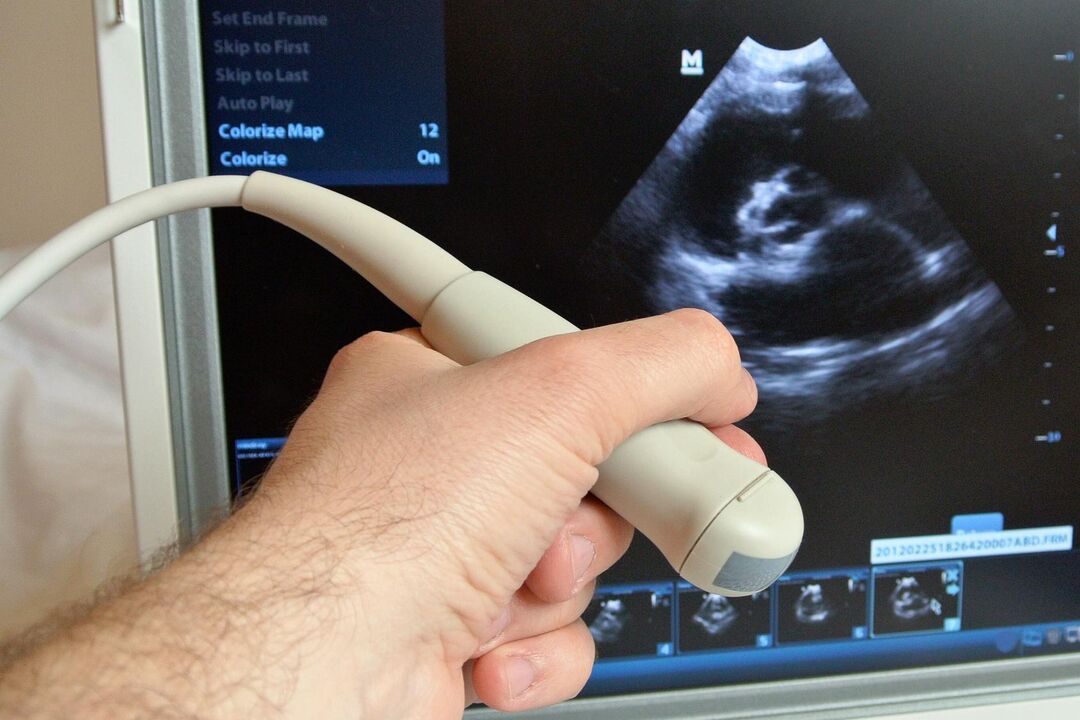 L'échographie aidera à diagnostiquer la prostatite congestive chez un homme. 