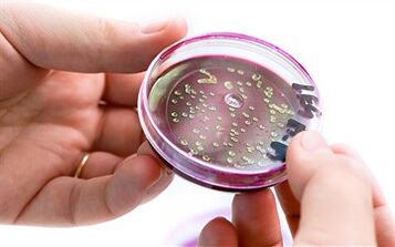 Bactéries dans la sécrétion de la prostate.